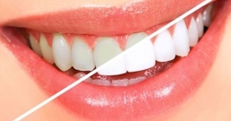 Избелете зъбите си по естествен начин, без химикали