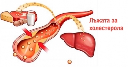 Лъжата за холестерола и как да намалим холестерола естествено