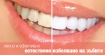 Лесно и ефективно естествено избелване на зъбите