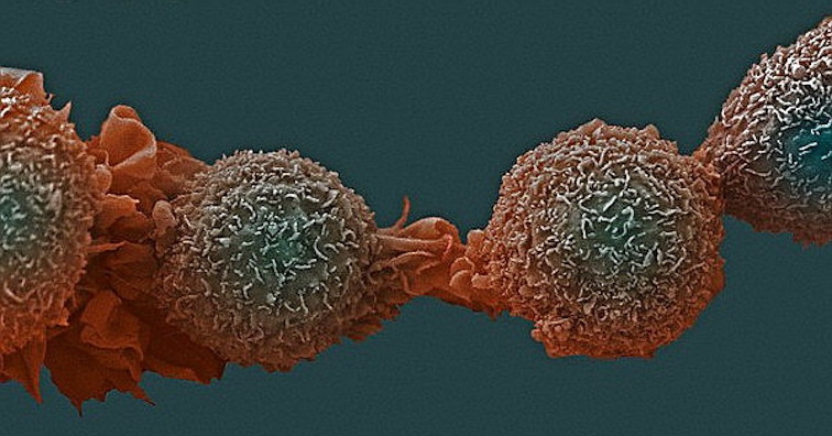 Топ 4 заплахи за рак