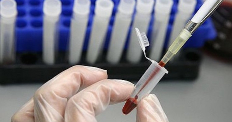 Тест за С-реактивен протеин, ако искаме да сме дълго млади