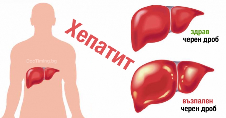 Хроничният хепатит може да доведе до тежки поражения в черния дроб и в други органи
