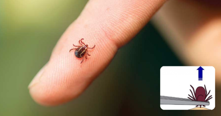 Специалист: Сами можем да извадим кърлеж, после се пие антибиотик