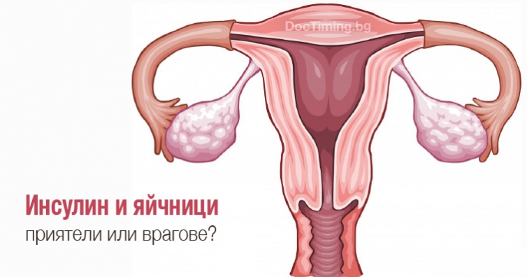 Инсулин и яйчници – приятели или врагове?