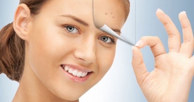 Победете акнето лесно и в домашни условия с тази рецепта