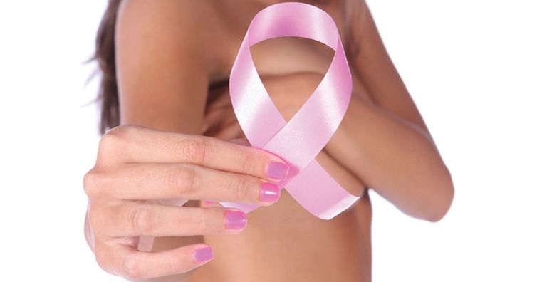 Какво не знаете за дифузния рак на гърдата?