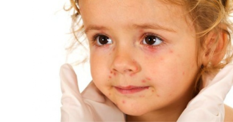 Опасна шарка пламна в Бургас