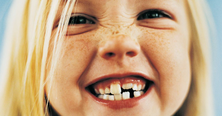 Силанти пазят зъбите на малчуганите