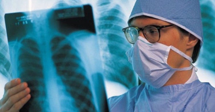 Безплатни прегледи за туберкулоза в УМБАЛ Св. Георги - Пловдив